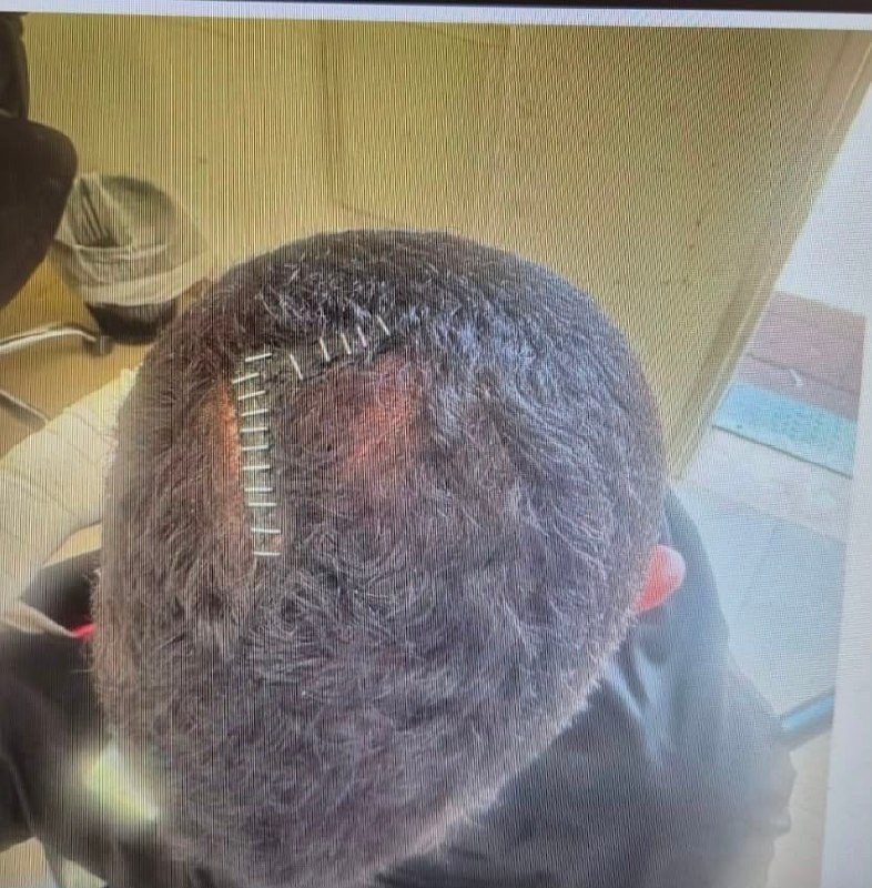 لائحة اتهام ضد شاب من جبل المكبر بتهمة الاعتداء الوحشي على شاب في القدس
